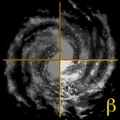 Quadrant Beta.jpg