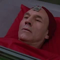 Neural caliper.jpg