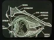 Eye diagram