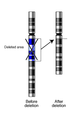 Deletion