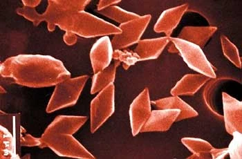 Kristali in spore Bacillus thurigensis
