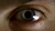 1X13 BooneEye.jpg
