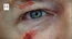 1x04 Locke Auge