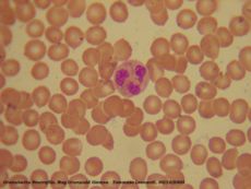 Neutrophil