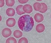 Eosinophil