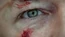 1X04 LockeEye