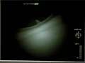 Thumbnail for version as of 19:16, January 31, 2008
