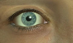 Elliot's eye.JPG