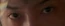 Miles Augen