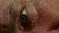 4x11Auge