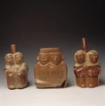 Conjoinedtwinslarcomuseum.jpg
