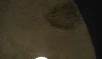 Radzinski stain