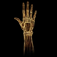 X ray hand