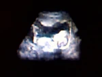 Ultrasound.jpg