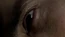 4x10Eye