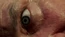 4x11LockeEye