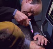 Subdermal scalpel