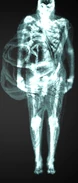 Pregnant Xray