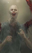 Slasher patient2