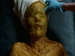 Pam's Body Peel