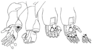 Gnz-003-arm
