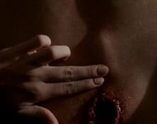 TheWound&TheWorm
