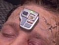 Neural stimulator, 2370s.jpg