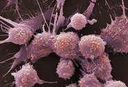 Cancer2