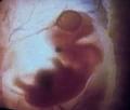 Ian Andrew Troi II embryo.jpg