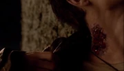 Will's bite
