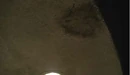 Radzinski stain.jpg