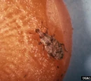 Carrot weevil