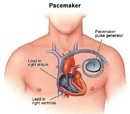 Pacemaker biology.jpg