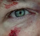 Eyes
