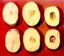 Manganese deficiency