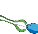 Gemini Laser
