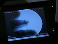 X-ray with the remains of John Cramer.