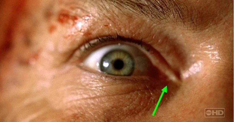 Image:Locke_eye_comparison.jpg