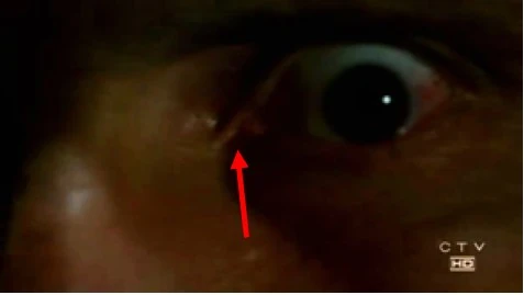 Image:The_eye.jpg