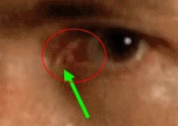 Image:Jacob Jack Eye.gif