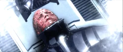 Darth Vader being fitted with his cybernetic breath mask.