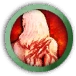 Resistance to Bleeding